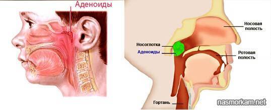 Густые белые сопли у ребенка, чем лечить?