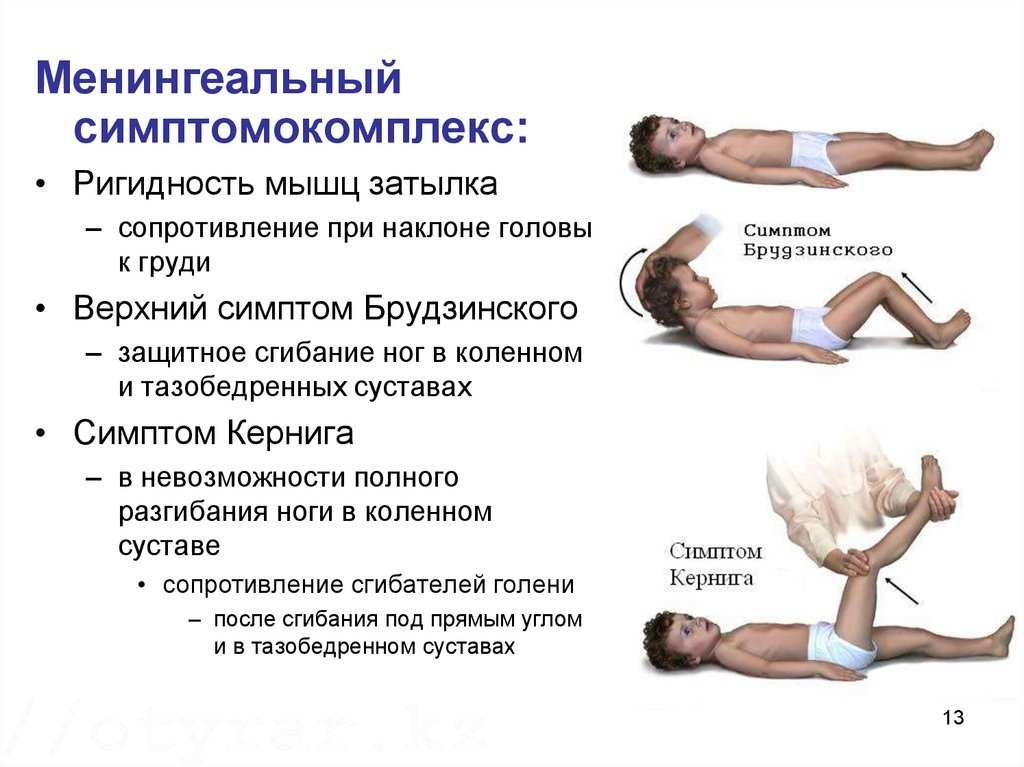 Менингококковая инфекция у детей
