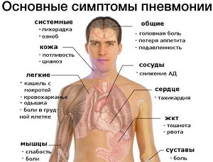 Горчичники при пневмонии – можно ли прогревание взрослым при воспалении легких