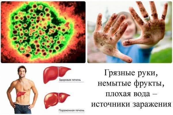 Как убрать желтизну глаз белков народными средствами