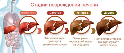 Диета при гепатозе печени примерное меню на неделю