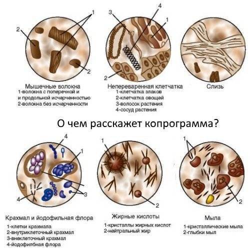 Йодофильная флора в кале у ребенка: норма и патологическая, причины, лечение