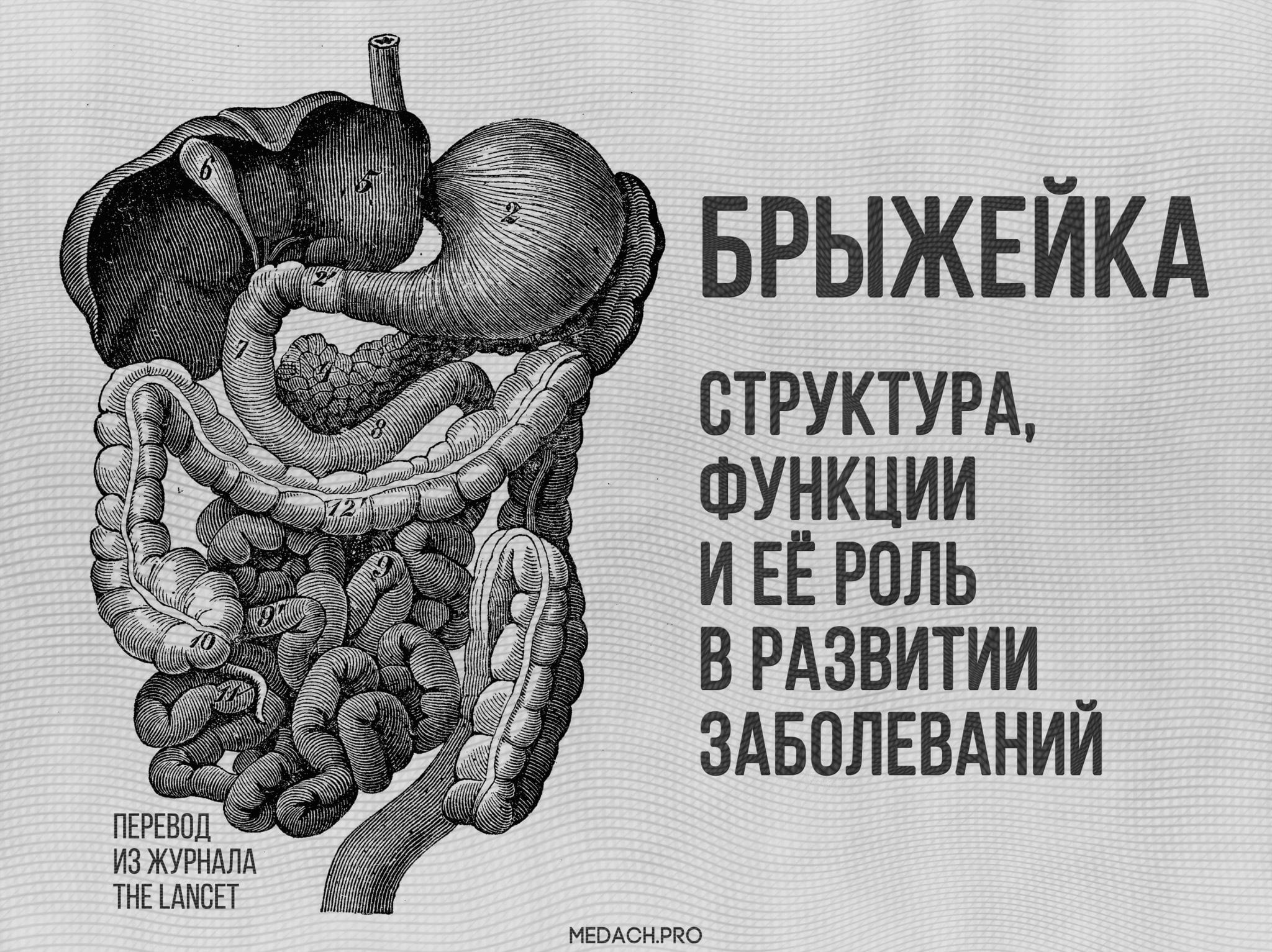 Заворот кишок
