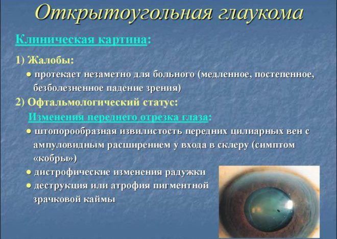 Эпинефрин