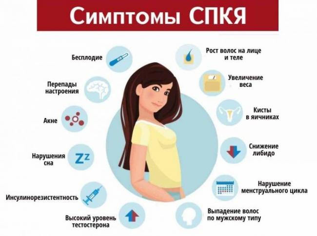 Синдром поликистозных яичников
