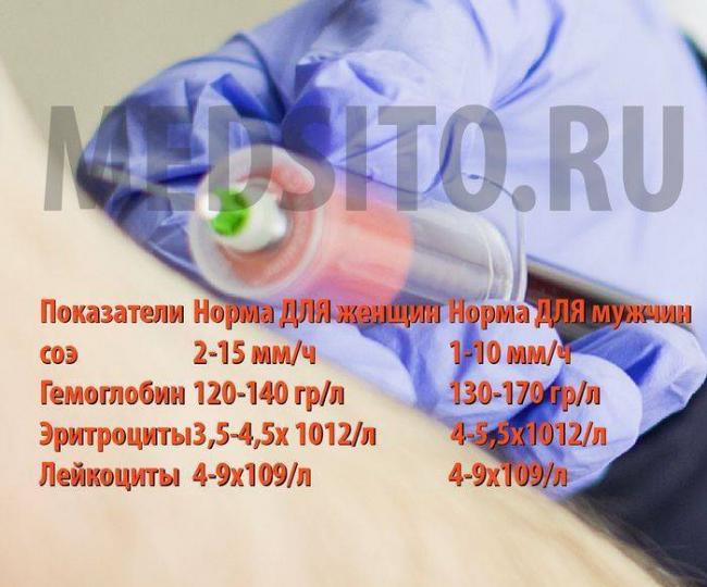 Показатели анализа крови при пневмонии у ребенка. о чем говорит повышение соэ?