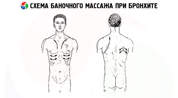 Рассказываем куда ставить горчичники при бронхите