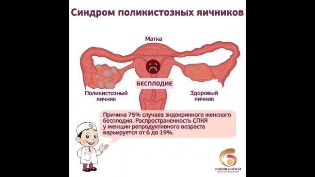 Что такое спкя и как его лечить