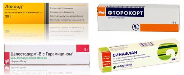 Нейродермит: симптомы и лечение 137232 11
