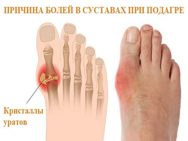 Аллопуринол-эгис таблетки — инструкция по применению