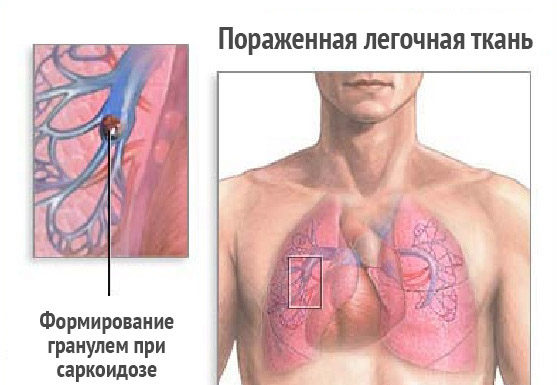 Трентал: инструкция по применению и для чего он нужен, цена, отзывы, аналоги