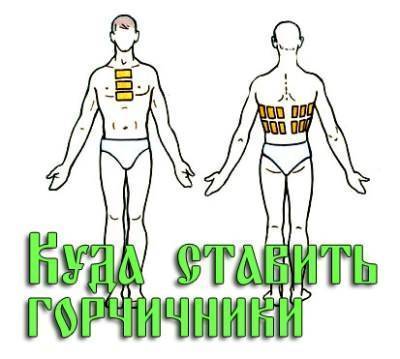 Горчичники при воспалении легких