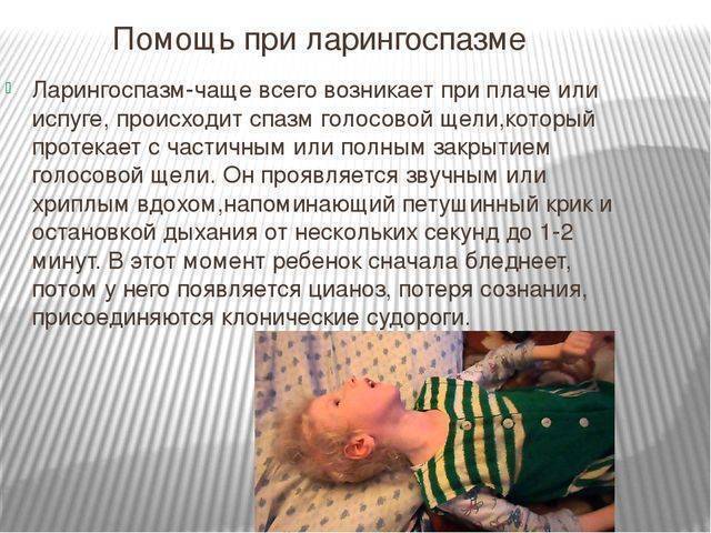 Кашель как ложный круп у ребенка чем лечить