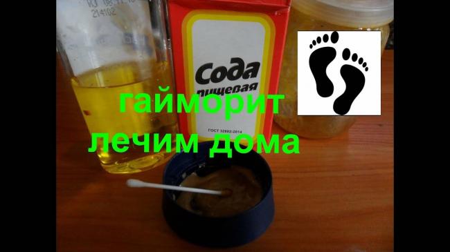 Как можно вылечить гайморит дома?