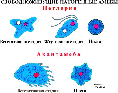 Акантамёбный кератит