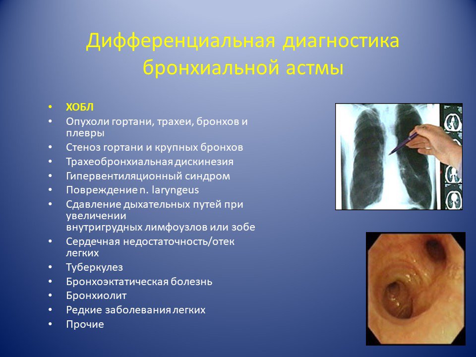 Основные проявления бронхиальной астмы: первые признаки и основные симптомы
