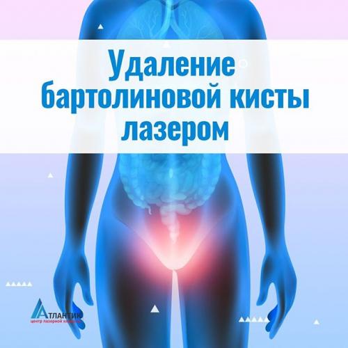 Бартолинит: причины, симптомы, лечение и последствия. народные методы лечения. операция при бартолините. применение при бартолините гипретонических компрессов, мази вишневского, антибиотиков, мазь левомеколь
