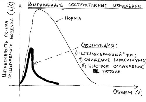 Спирография - что это такое и как её проводят, показания и подготовка к обследованию легких