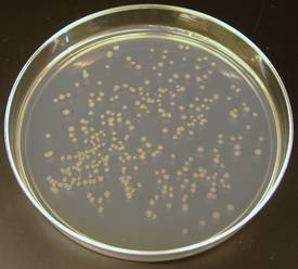 Escherichia coli в моче в 10 в 8