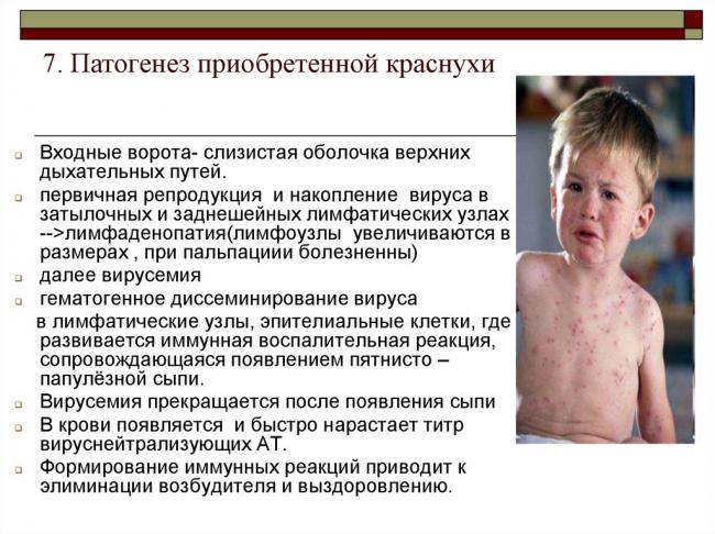 Парвовирусная инфекция: заражение, формы, симптомы, лечение