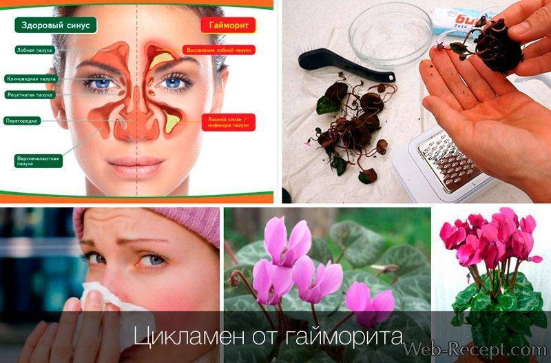 Лекарство от гайморита недорогое и эффективное