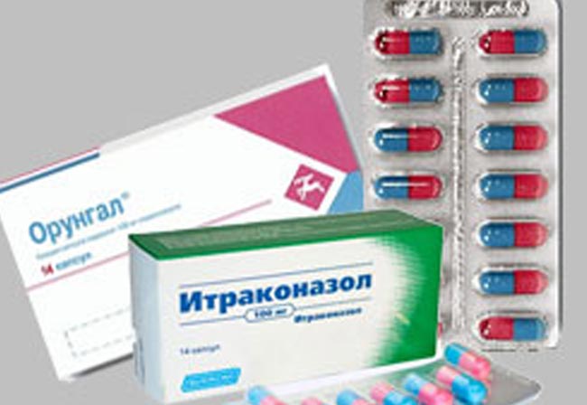 Как лечиться ирунином при грибке ногтей. отзывы