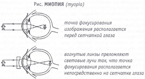 Пленка на глазу человека причины и лечение