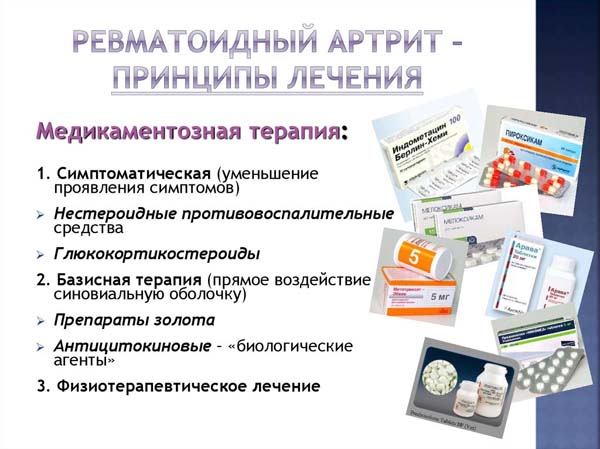 Ревматоидный артрит – симптомы, лечение и классификация