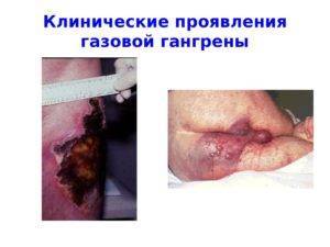 Общая характеристика наиболее опасных клостридиозов жвачных