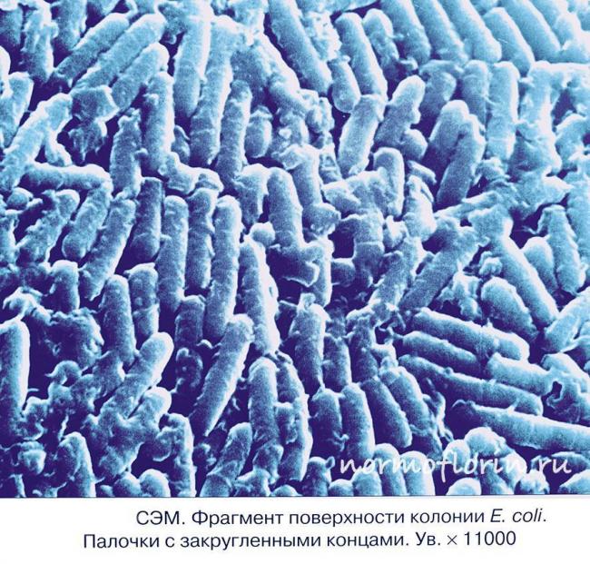 Escherichia coli 10/6 в моче