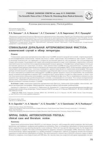 Артериовенозная фистула - dural arteriovenous fistula