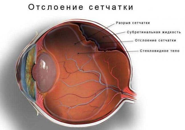 Тонометрия глаза по маклакову, норма