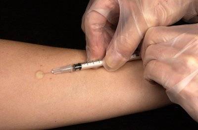 Аллергия на реакцию манту