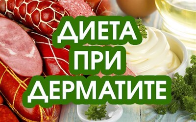 Аллергический дерматит диета