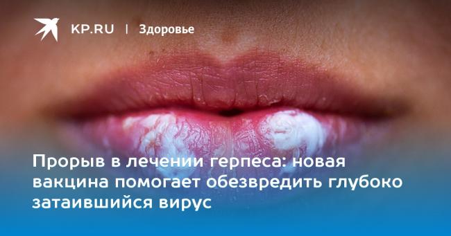 Диета при герпесе на теле