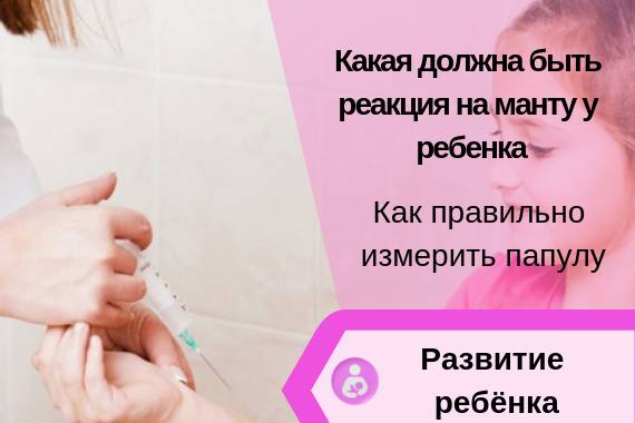 Какого размера должна быть норма реакции на прививку манту