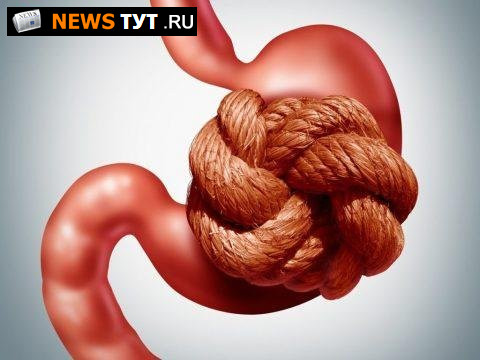 Препараты для очищения кишечника: список лучших средств