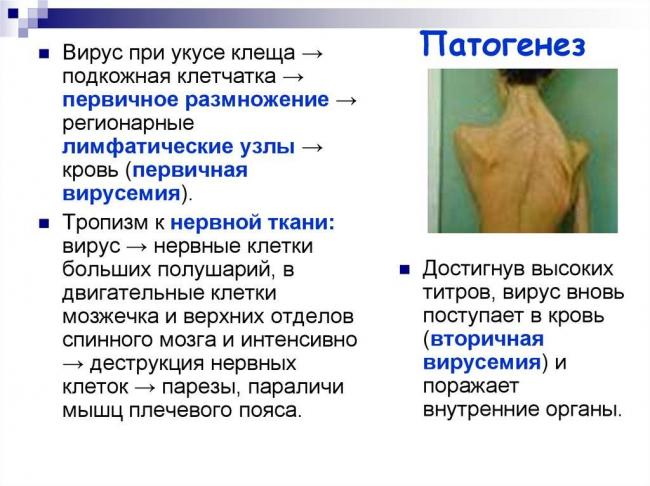 Парвовирусная инфекция: заражение, формы, симптомы, лечение