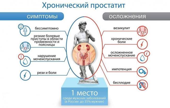 Как вылечить острый простатит