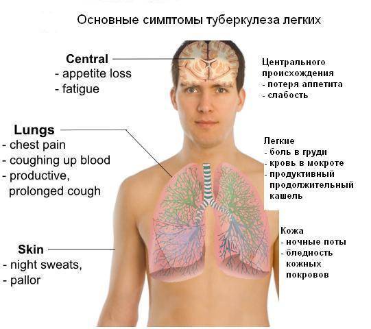 Абсцесс | блокнот фтизиатра - туберкулез