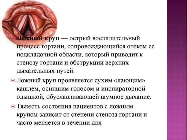 Ложный круп у детей – причины, симптомы и лечение