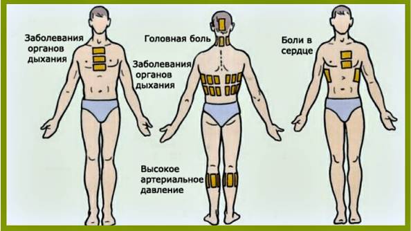Горчичники — польза и вред для организма при кашле и бронхите, как правильно ставить аппликации детям и взрослым