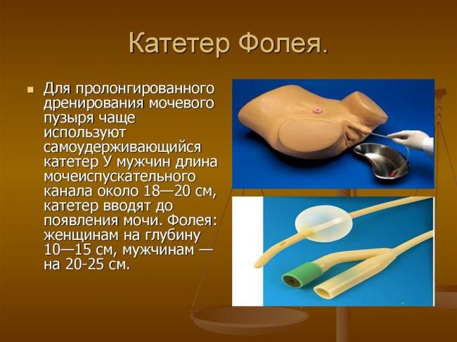 Как проводится катетеризация у женщин?