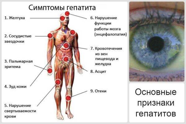 Желтые круги вокруг глаз. причины и лечение