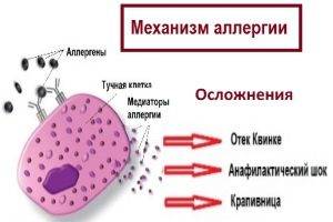 Аллергия на стиральный порошок