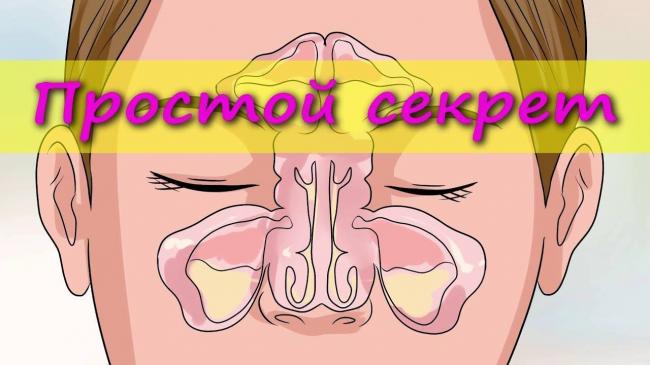 Слизь в носоглотке: как избавиться в домашних условиях, причины и лечение