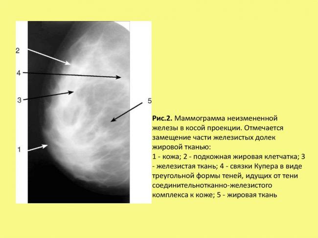 Строение молочной железы у женщин, анатомия женской груди, уход за грудью