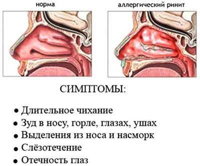 Купание ребёнка: можно ли проводить водные процедуры при насморке
