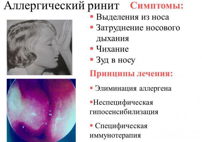 Спрей назальный авамис