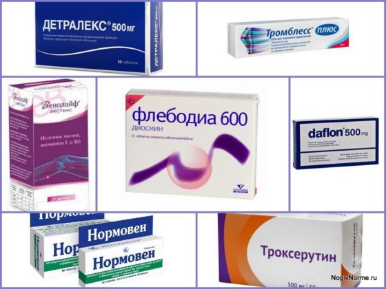 Препарат "венодиол": инструкция по применению, отзывы, аналоги